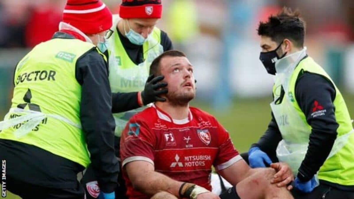 Concussion in sport Saliva test is 94% accurate in rugby union trial Concussion in sport Saliva test is 94% accurate in rugby union trial