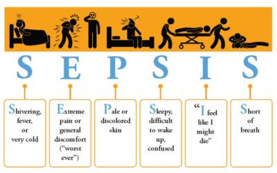 SEPSIS