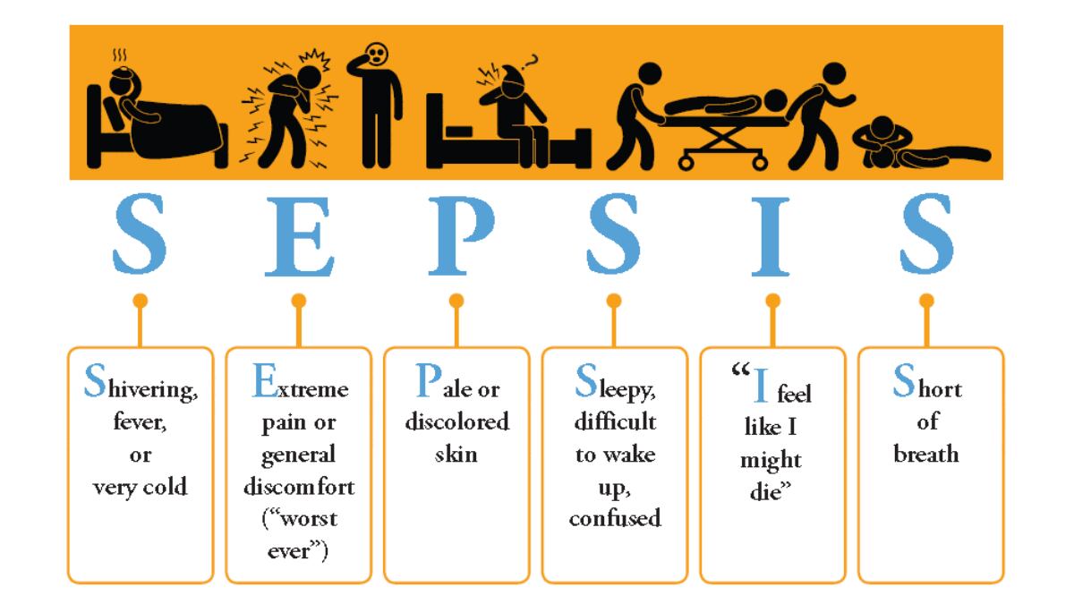 SEPSIS